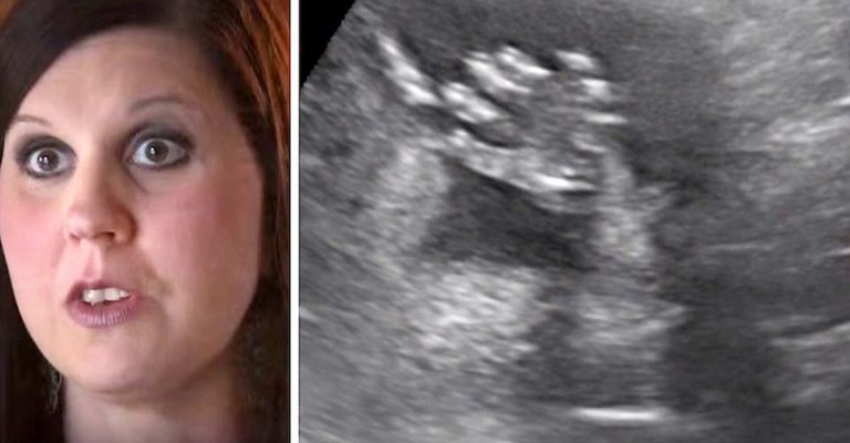 Mom Thinks Her 5th Pregnancy Is the Surprise. Then, Her Ultrasound